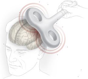 Estimulação transcraniana