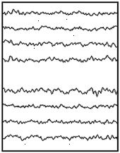 EEG normal