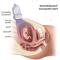 Ilustração de ultra-som fetal transabdominal
