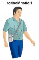 Ilustração de um homem que usava um monitor Holter
