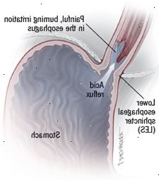 Azia ilustração