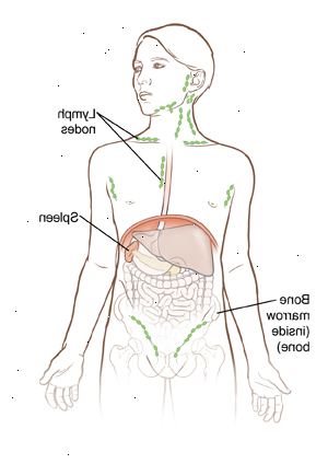 Os nódulos linfáticos, medula óssea e do baço são todas as partes do sistema linfático. Este sistema funciona para ajudar o organismo a combater infecções.