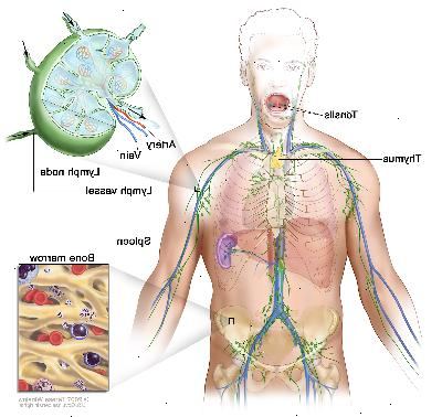 Sistema linfático; desenho mostra os vasos linfáticos e órgãos linfáticos, incluindo os gânglios linfáticos, amígdalas, timo, baço e medula óssea. Uma inserção mostra a estrutura dentro de um nó de linfa e os vasos linfáticos ligados com setas que mostram como a linfa (líquido claro) move-se para dentro e para fora do nó de linfa. Outro detalhe mostra um close-up de medula óssea com células do sangue.