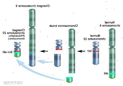 Cromossoma Filadélfia; desenho de três painel mostra um pedaço do cromossomo 9 e um pedaço do cromossomo 22 quebrando e locais de comércio, a criação de um cromossomo alterado 22 chamado de cromossomo Filadélfia. No painel da esquerda, o desenho mostra um cromossoma 9 normal com o gene abl e um cromossoma 22 normal com o gene BCR. No painel do centro, o desenho mostra cromossomo 9 quebrando no gene abl e cromossomo 22 quebrando abaixo do gene BCR. No painel da direita, o desenho mostra cromossoma 9 com a parte do cromossoma 22 e cromossoma 22 ligado com a peça a partir do cromossoma 9, contendo parte do gene abl anexado. A mudança de cromossomo 22 com o gene BCR-ABL é chamado de cromossomo Filadélfia.