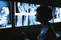 Imagem de um médico a visualização enema opaco filmes de raios-x