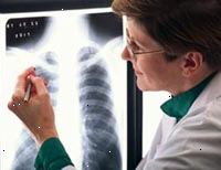 Imagem de um radiologista fêmea lendo um raio-x