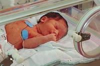 Imagem de um bebê na unidade de terapia intensiva neonatal