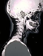 Uma imagem de um raio-x da cabeça