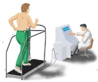 Ilustração mostrando um ECG exercício